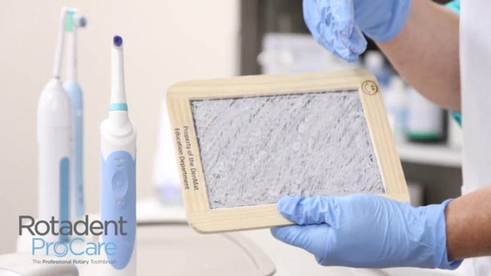 VIDEO: The Rotadent ProCare™ Chalkboard Challenge – A power Toothbrush Comparison