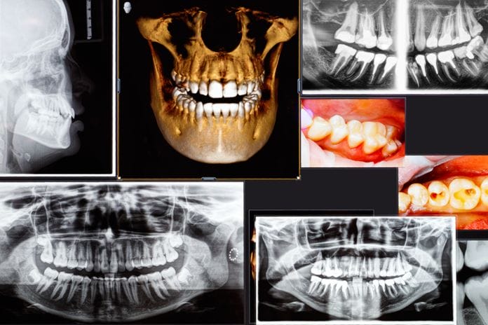 3D cone beam radiographs