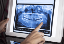 Tips for When Patients Question or Refuse Radiographs