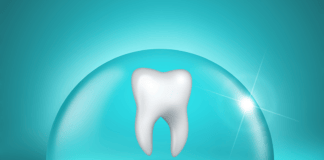 silver diamine fluoride