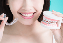 A Life Behind Bars or a Future You Can See: Traditional Braces vs. Clear Aligners