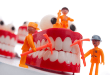 Ask Kara RDH: Full Mouth Debridement before Prophy