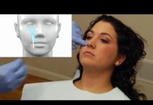 VIDEO: Maxillary Anesthesia Injection Techniques