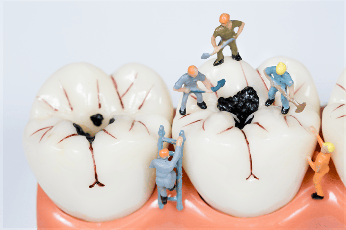 A David vs. Goliath Tale about Dental Caries