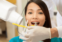 QUIZ: Test your Dental Radiograph Knowledge!