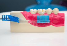 New AAP Periodontal Classification Guidelines