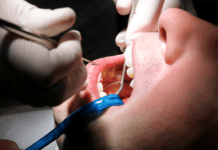 Periodontal Maintenance: Taking the Guesswork Out of the 4910