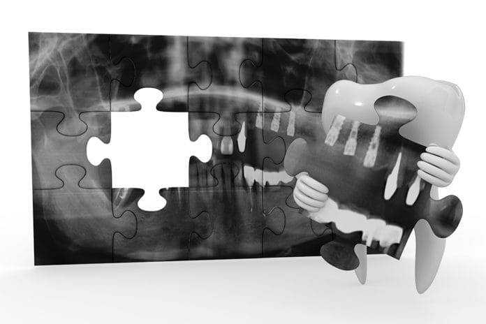 The Forensic Puzzle: How Dental Professionals Play a Vital Role in the World of Forensics