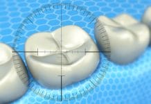 Topical vs. Systemic Fluoride: What Patients Need to Know