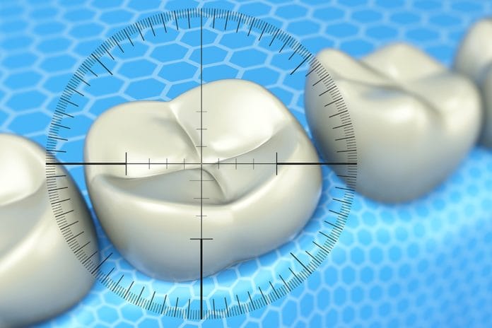 fluoride today's rdh dental hygiene