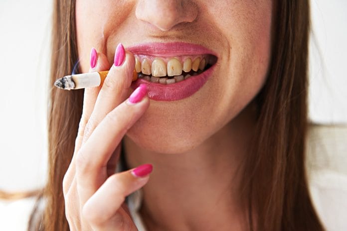Further Evidence Shows Smoking May Impact Healing Rate after Dental Treatment