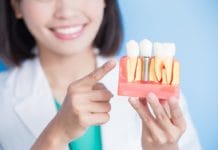 5 Step Implant Assessment