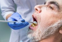 Link between Tongue Microbiota and Pneumonia in Geriatric Patients
