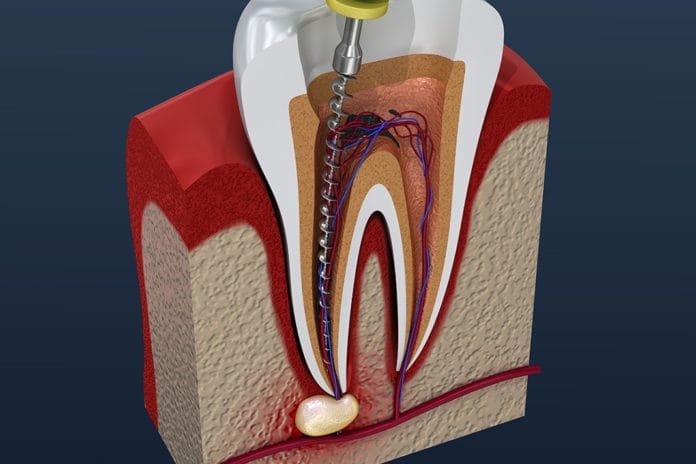 Scientists Discover How to Regenerate Dental Pulp after Root Canal Treatment