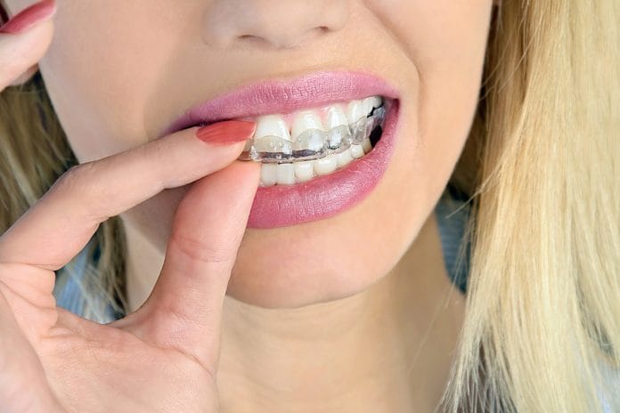 Is Teeth Whitening Really Safe?