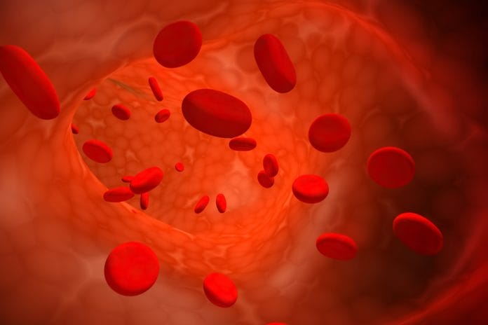 Iron-Deficiency Anemia: What Dental Hygienists Need to Know