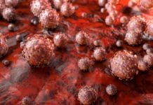 Survey Assesses Dental Hygienists Knowledge and Practices Towards HPV