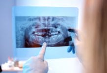 What Hygienists Should Say When Patients Refuse Dental Radiographs