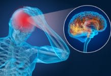 Researchers Find Groundbreaking Connection between Oral Bacteria and Stroke