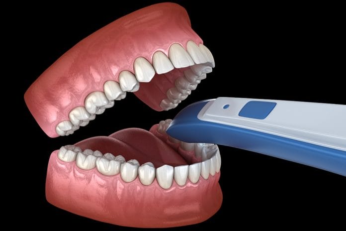 Dental Intraoral Scanner