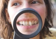 What Hygienists Need to Consider when Treating Patients with Malocclusion