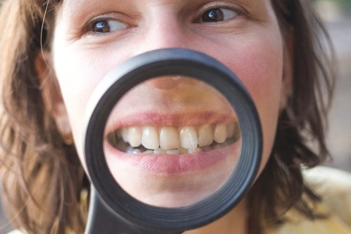 What Hygienists Need to Consider when Treating Patients with Malocclusion