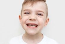 Research Examines Whether People Are Genetically Predisposed to Tooth Decay