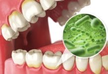 Gum Disease Linked to Serious Health Conditions