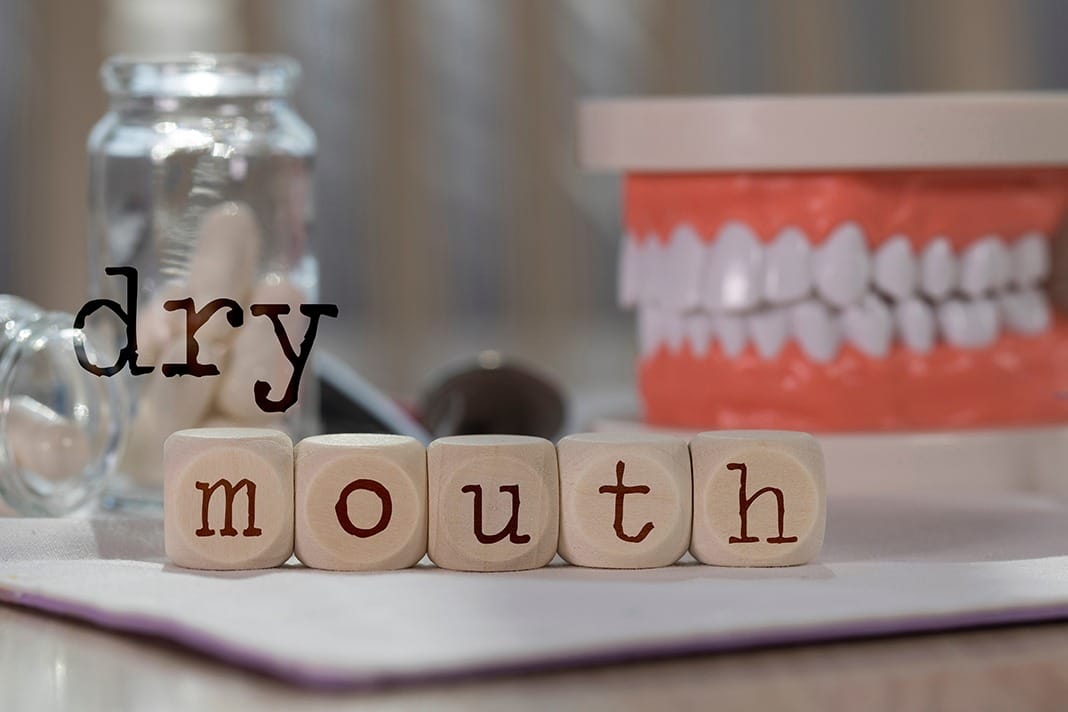 Xerostomia and Periodontal Disease How to Customize Your Treatment