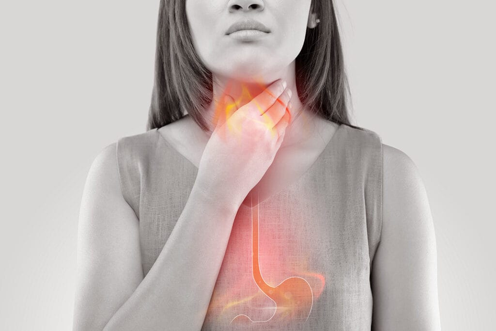 Dental Erosion Is It Heartburn, Acid Reflux, or GERD? Today's RDH