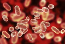 Porphyromonas Gingivalis Linked to Diabetes and Heart Disease