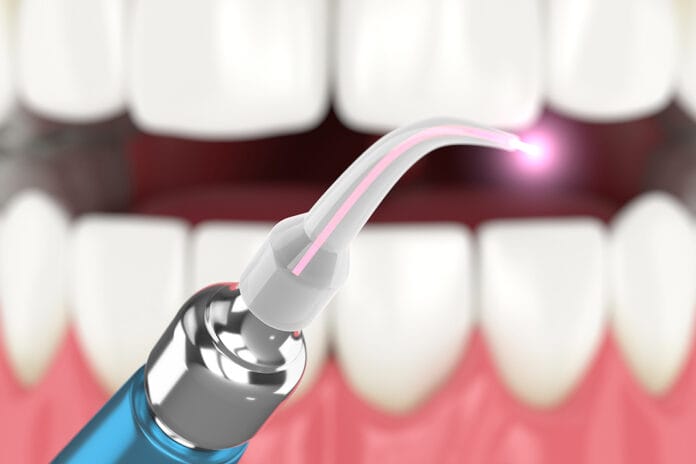 laser periodontal surgery