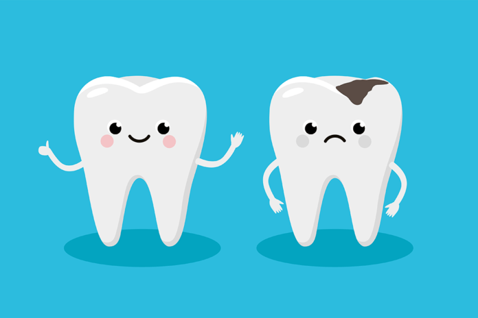 QUIZ: Test Your Cariology Knowledge