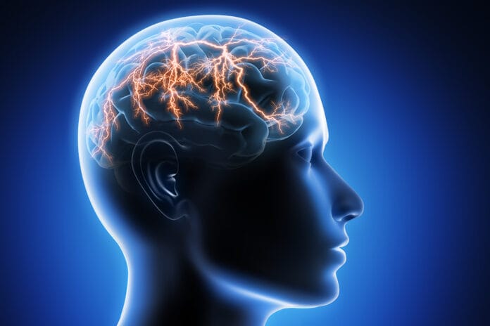 epilepsy dental patients