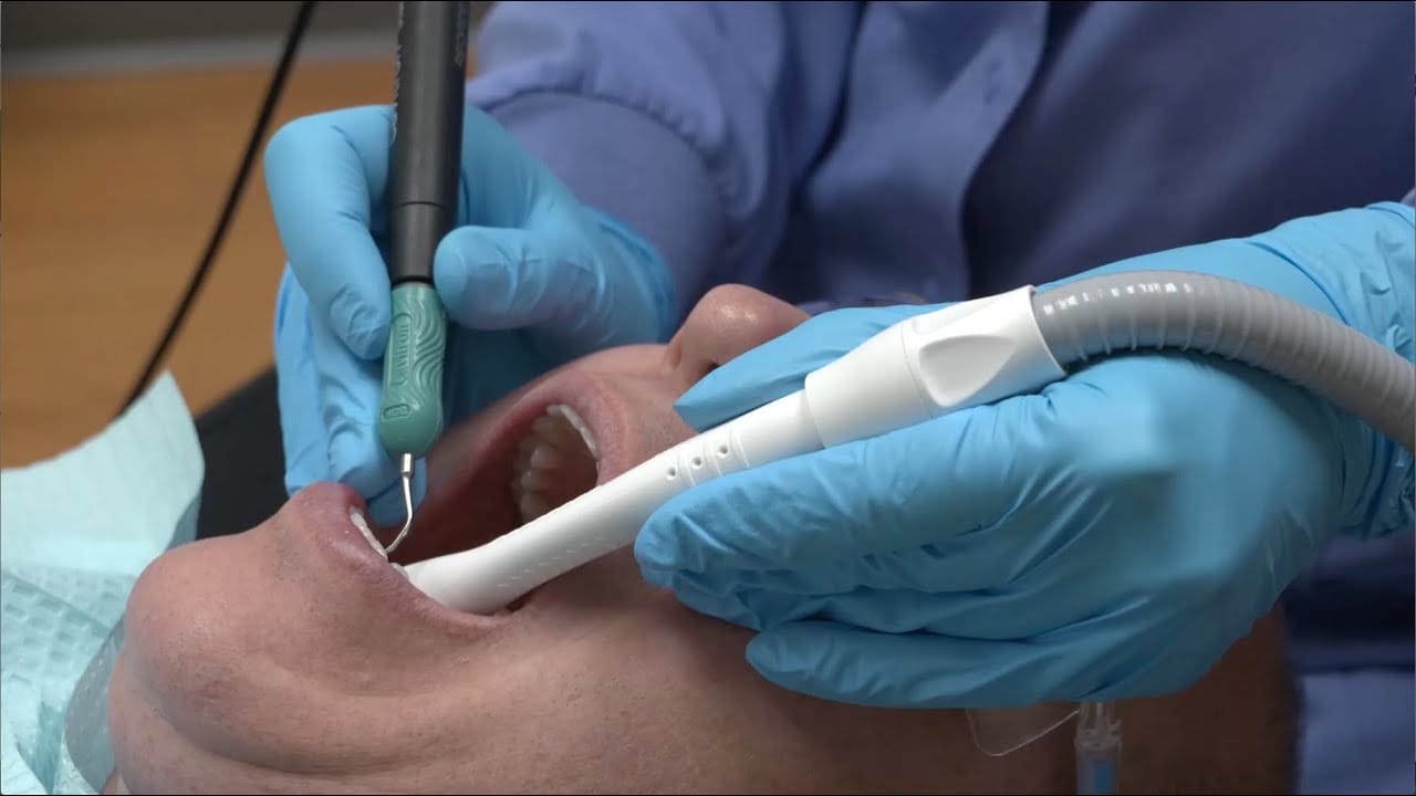 VIDEO Purevac® HVE System Fluid Management Today's RDH