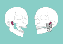Scientists Discover New Muscle Layer in the Human Jaw