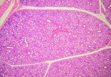 Ionocyte Cells: New Discovery Hints at Promise for Salivary Gland Repair