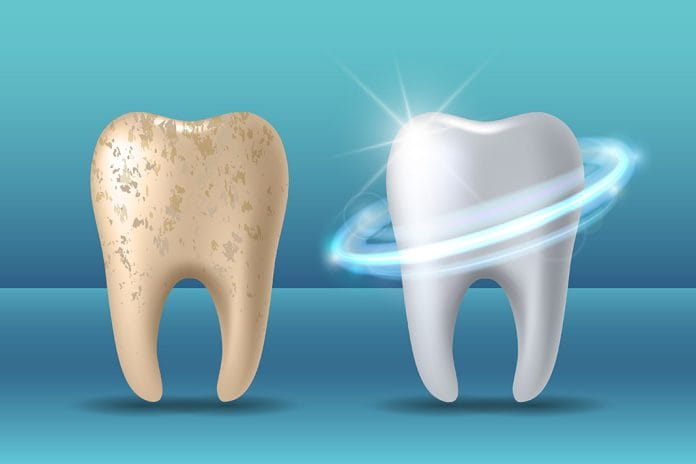 From NASA to Your Mouth: The Dental Benefits of Nano-hydroxyapatite ...