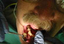 Evidence-Based Dental Care: Evolution of SRP, FMD, and Subgingival Irrigation