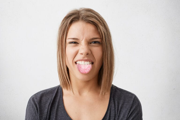 Geographic Tongue Dental Hygienists Can Help Locate Lesions and Guide
