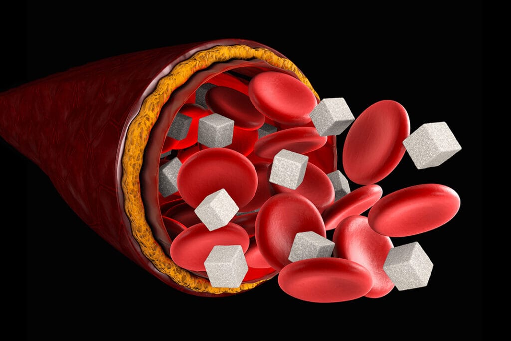 High Sugar In Urine But Low Sugar In Blood