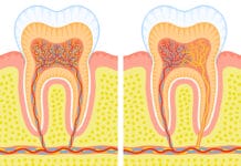 QUIZ: Test Your Periodontium Knowledge