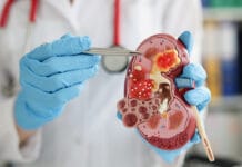 The Oral Health Connection to Chronic Kidney Disease