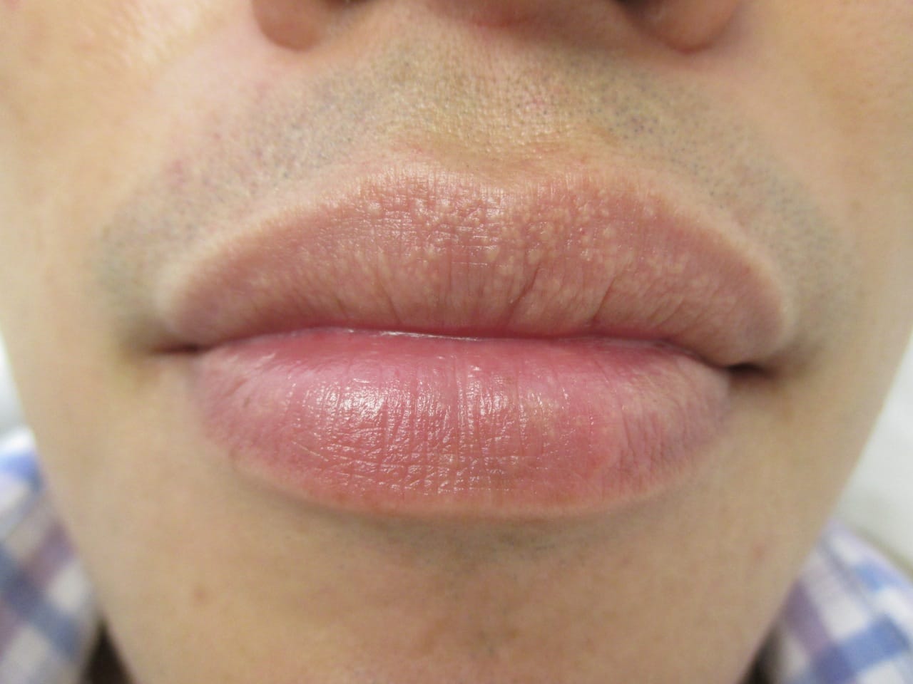 Kiss and Tell Variations of Normal and Pathology of the Lips