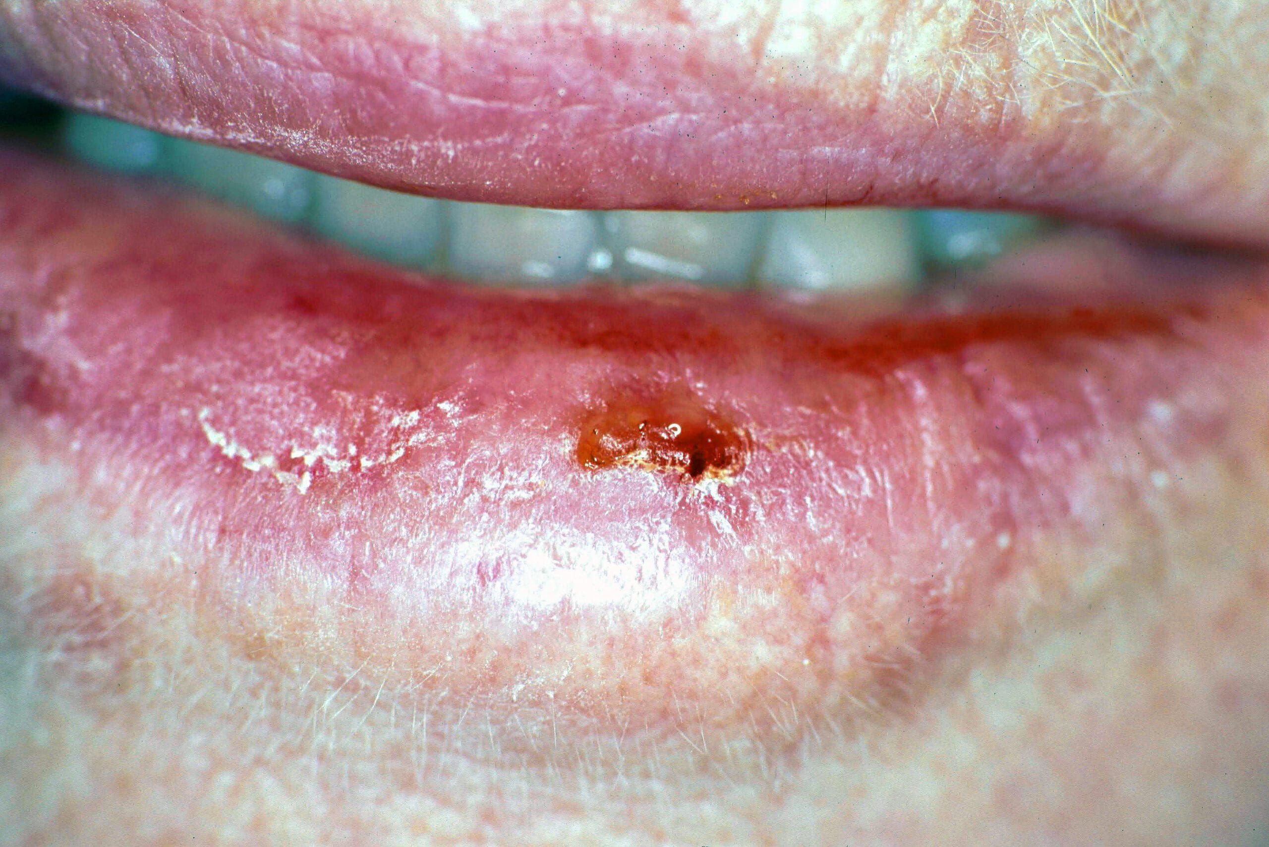 Kiss and Tell Variations of Normal and Pathology of the Lips