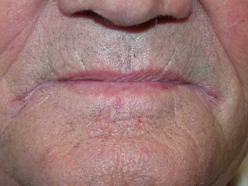 Kiss and Tell Variations of Normal and Pathology of the Lips