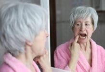 An Overview of Amalgam Tattoos for the Dental Hygienist