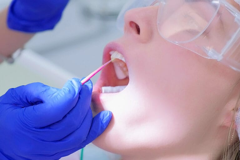 QUIZ Test Your Fluoride Varnish Knowledge Today's RDH