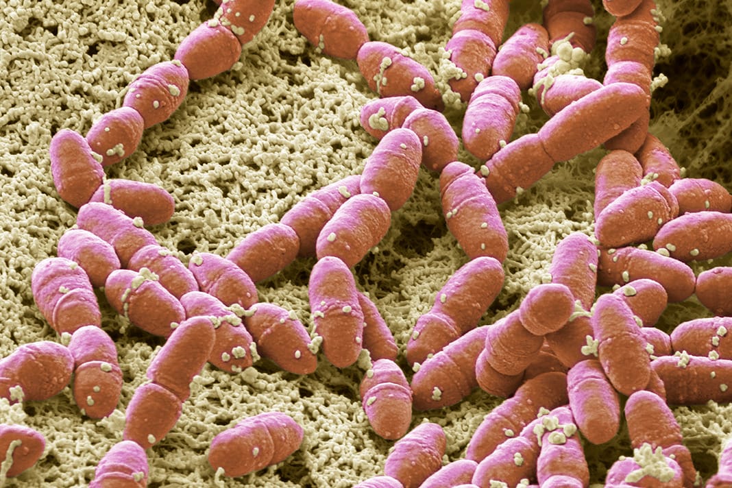 research-reveals-new-possible-pathogens-related-to-the-severity-of