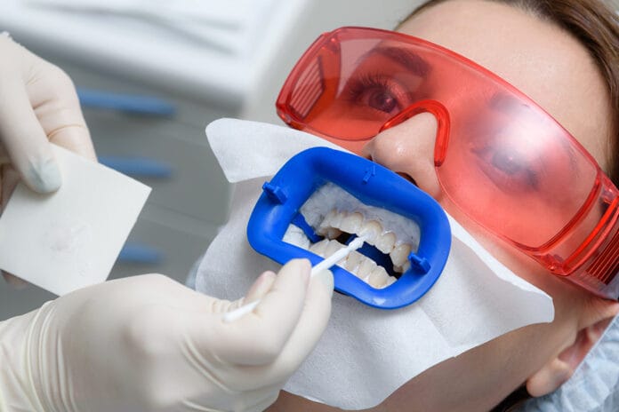 teeth whitening research